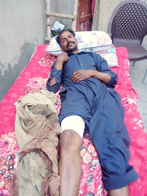 Waqas Masih is recovering after March 23, 2024 attack in Faisalabad District, Pakistan. 