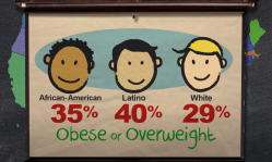 Severe obesity growing in American children under 5 is ‘nearly irreversible’: study