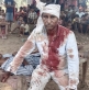 Pastors and other Christians brutalized in Odisha state, India