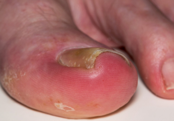 A toe, a tooth, and the theology of perspective