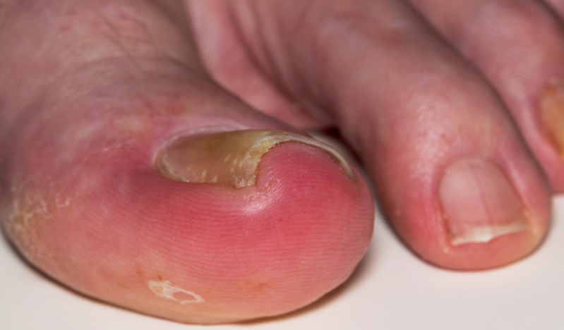 A toe, a tooth, and the theology of perspective