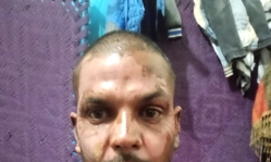 Muslim in Pakistan sets Christian on fire over petty dispute