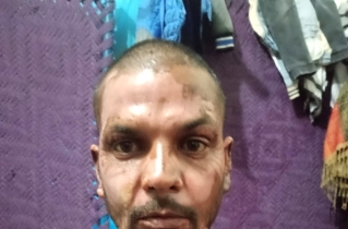 Muslim in Pakistan sets Christian on fire over petty dispute