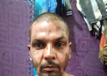 Muslim in Pakistan sets Christian on fire over petty dispute