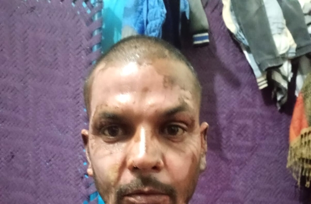 Muslim in Pakistan sets Christian on fire over petty dispute